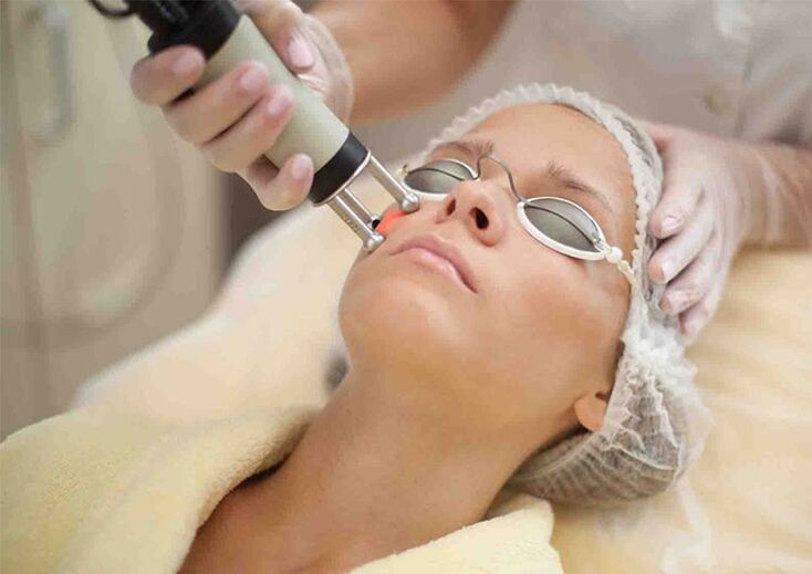 Procedementos de rexuvenecemento da pel con láser arredor dos ollos